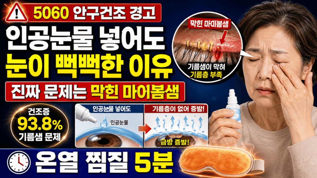 마이봄샘 기능부전 안구건조증 60대 온열 찜질 눈꺼풀 기름샘